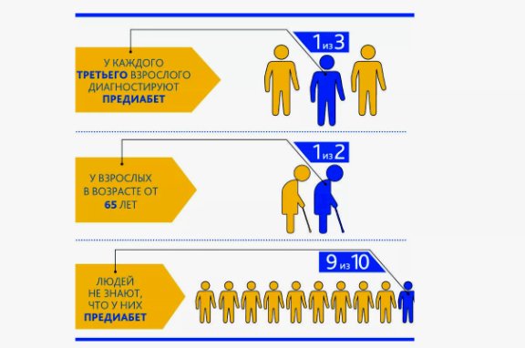 Признаки развития диабета II типа